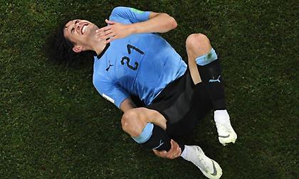 Ελπίδες για Καβάνι κόντρα στη Γαλλία!