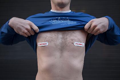 Ο οδυνηρός τραυματισμός των θηλών των δρομέων!