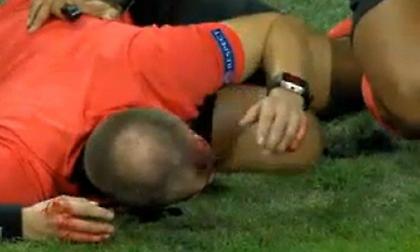 Άνοιξε το κεφάλι του επόπτη από μπουκάλι στο Στουρμ Γκρατς-ΑΕΚ Λάρνακας! (pic)