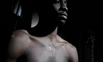 Τζεφ Γκριν: Η ουλή που του άλλαξε τη ζωή!