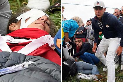 Γυναίκα έχασε την όραση στο ένα μάτι από μπαλάκι γκολφ και κάνει μήνυση