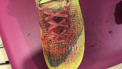 Σοκάρει η φωτογραφία με το ματωμένο παπούτσι του Λούκας Πέρεθ (pic)