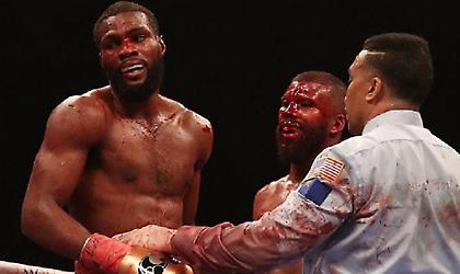 Ο πιο αιματηρός αγώνας πυγμαχίας (pics)