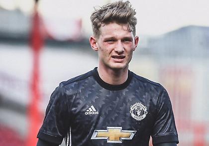 Ανταποκρίνεται στις χημειοθεραπείες και παλεύει γερά νεαρός αμυντικός της Γιουνάιτεντ