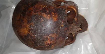 Βρέθηκε το κλεμμένο κρανίο της μούμιας του σταυροφόρου