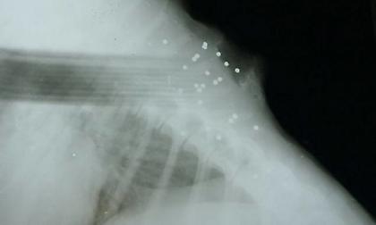 Φρίκη στα Χανιά: Πυροβόλησε σκύλο εξ επαφής και στη συνέχεια τον μαχαίρωσε