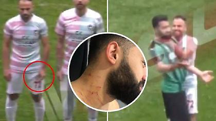 Ισόβιος αποκλεισμός στον Τούρκο παίκτη με το ξυράφι (video)