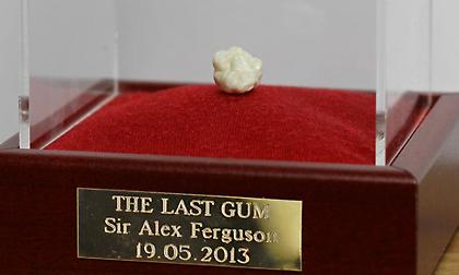 Αστρονομικό ποσό για την... τελευταία τσίχλα που μάσησε ο Φέργκιουσον