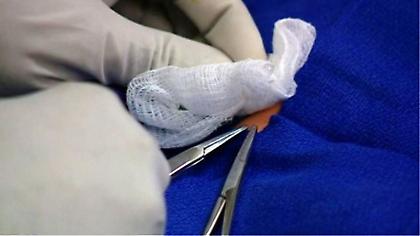 Τραγικός θάνατος για βρέφος 5 μηνών στην Ιταλία μετά από περιτομή που του έκαναν οι γονείς του