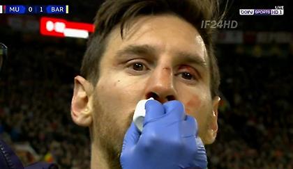 Προκάλεσε αιμορραγία στον Μέσι ο Σμόλινγκ (video)