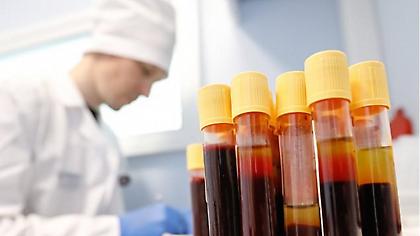 Στη Ρωσία θα βάζουν πρόστιμο σε όσους υποστηρίζουν ότι ο ιός HIV είναι κατασκεύασμα