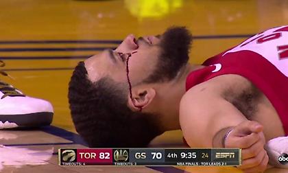 Έχασε δόντι και έκανε ράμματα ο ΒανΒλιτ (video)