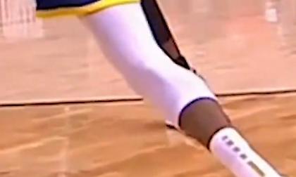 Καρέ-καρέ ο τραυματισμός του Ντουράντ (video)