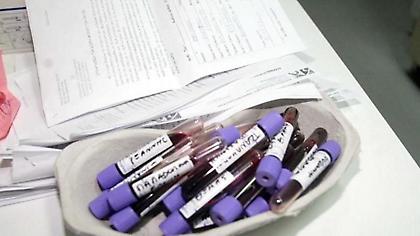 Αναστέλλονται οι κινητοποιήσεις στα διαγνωστικά κέντρα