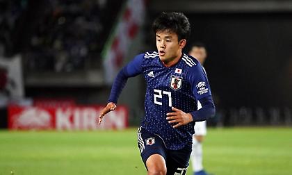 Φαινόμενο (Αντετο)Κούμπο στην Ρεάλ Μαδρίτης