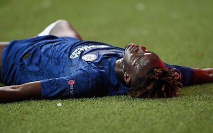 Η εκδίκηση των οπαδών της Λίβερπουλ στον Έιμπραχαμ (pic)