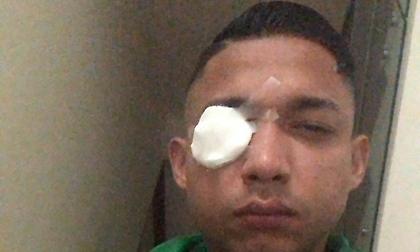 Επεισόδια με τρεις νεκρούς σε αγώνα στην Ονδούρα, τραυματίστηκε ο Ιζαγκίρε