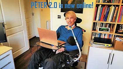 Ετοιμοθάνατος επιστήμονας μετατρέπει τον εαυτό του στο πρώτο cyborg