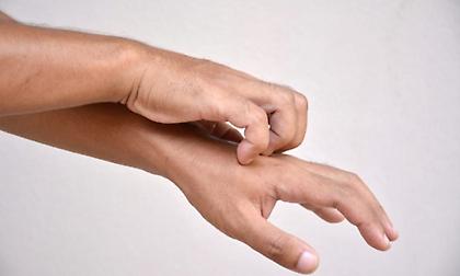 Τι μπορεί να σημαίνει η φαγούρα στα άκρα τις βραδινές ώρες;