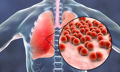 Κίνα: Πρώτος θάνατος από τη μυστηριώδη πνευμονία