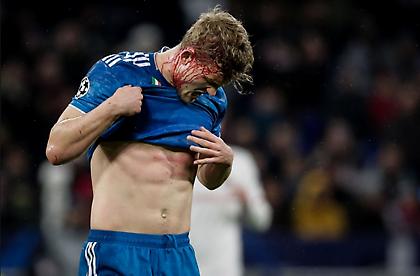 Άνοιξε το κεφάλι του Ντε Λιχτ (pics/video)