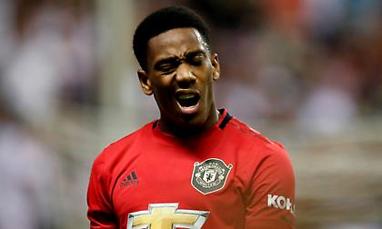 Κουρεύτηκε γουλί και δέχθηκε… καζούρα ο Μαρσιάλ (pics)