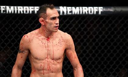 Αυτός είναι ο νέος αντίπαλος του Φέργκιουσον αντί του Νουρμαγκομέντοφ