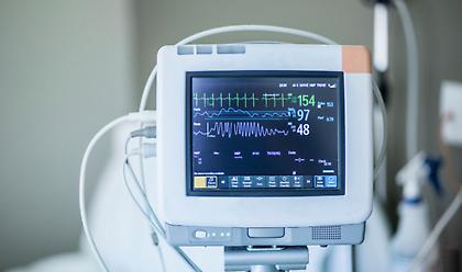 ΕΚΕ: Δωρεά φορητών Καρδιογράφων και Υπερηχογράφων «παλάμης» σε νοσοκομεία αναφοράς