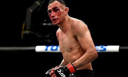 Ο Φέργκιουσον ποζάρει από το νοσοκομείο μετά το κάταγμα στον οφθαλμικό κόγχο!