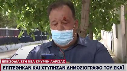 Γαρουφαλιάς για επίθεση Ρομά: «Με χτύπησαν την ώρα του ρεπορτάζ»