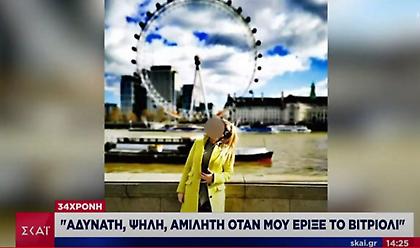 «Ψηλή κι αδύνατη αυτή που μου έριξε βιτριόλι» περιγράφει η 34χρονη