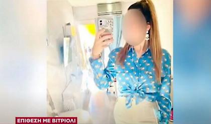Επίθεση με βιτριόλι: Συνεχίζονται οι έρευνες της αστυνομίας