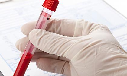 Ξέρεις να «διαβάζεις» τις αιματολογικές σου εξετάσεις;