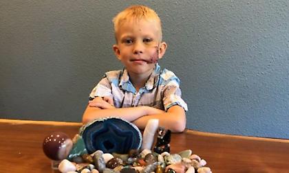 Η Παγκόσμια ομοσπονδία πυγμαχίας βράβευσε το 6χρονο που έσωσε τη μικρή του αδελφή από επίθεση σκύλου