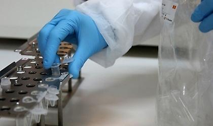 Κορωνοϊός - Γερμανία: Στους 9.095 οι νεκροί - 454 τα κρούσματα