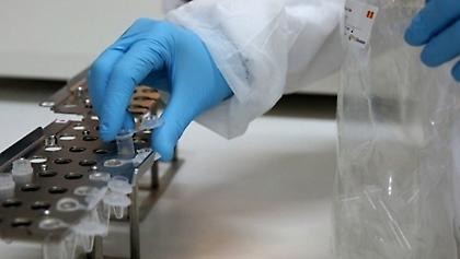 Ο χάρτης του κορωνοϊού στην Ελλάδα: 18 εισαγόμενα κρούσματα - 73 Αττική - 37 Θεσσαλονίκη