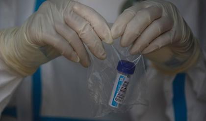 ΗΠΑ: Ξεπέρασαν τις 180.000 οι θάνατοι από κορωνοϊό