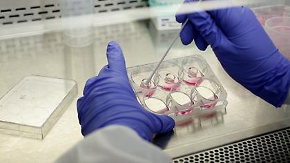 Κορωνοϊός- Ελλάδα: Ραγδαία αύξηση με 372 νέα κρούσματα-Tα 164 απο συρροή