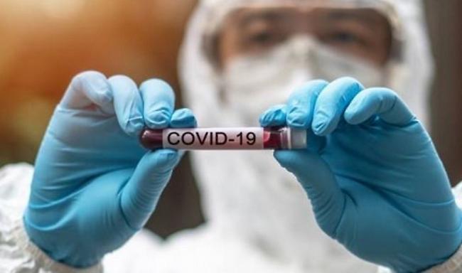 Κορωνοϊός- Ελλάδα: 310 νέα κρούσματα -3 νέοι θάνατοι - 67 διασωληνωμένοι