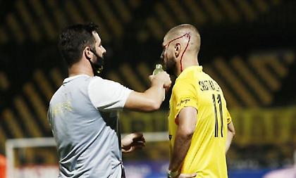 Χτύπησε ο Λόπεθ και συνεχίζει με ράμματα