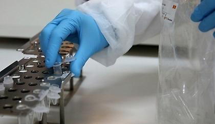 Κορωνοϊός: Τα διδάγματα από τις επιδημίες AIDS και έμπολα