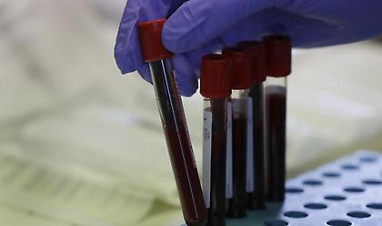 Κορωνοϊός: Το εμβόλιο Pfizer διατηρείται σε-70 βαθμούς- Θα είναι πρόβλημα για τα νοσοκομεία;