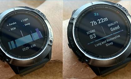 Τι είναι το στάδιο ύπνου REM και γιατί είναι ευεργετικό για τον οργανισμό μας;