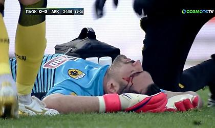 Συγκρούστηκε με τον Ουάρντα και μάτωσε ο Τσιντώτας (video)