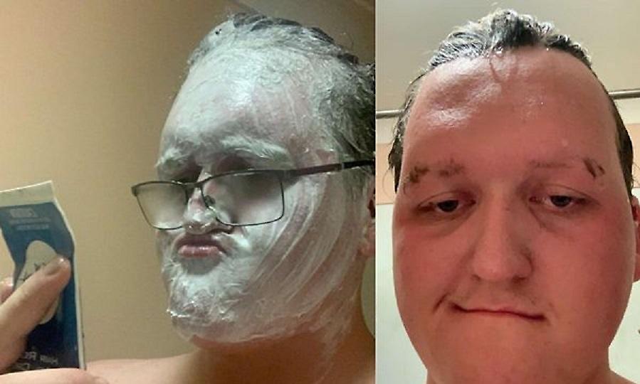 Τύπος έβαλε στο πρόσωπό του κρέμα αποτρίχωσης αντί για αφρό ξυρίσματος