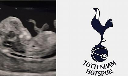 Οπαδός της Τότεναμ είδε στο υπερηχογράφημα του μωρού του το σήμα της ομάδας (pic)