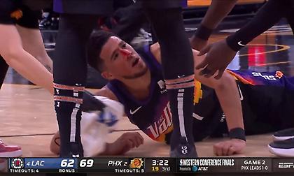 Μάτωσε και έκανε ράμματα στη μύτη ο Μπούκερ μετά από κεφαλιά του Μπέβερλι!