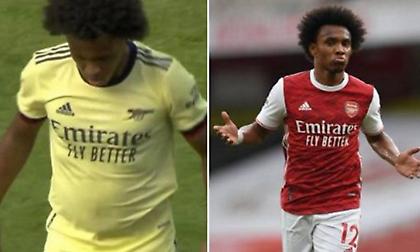 Εμφανίστηκε με… μπάκα στο φιλικό της Άρσεναλ ο Γουίλιαν!