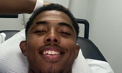 Κάταγμα περόνης ο Φοφανά