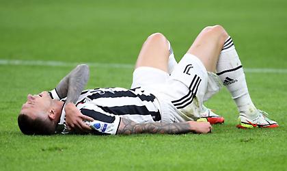 Χάνει Μπερναρντέσκι για δύο εβδομάδες η Γιουβέντους